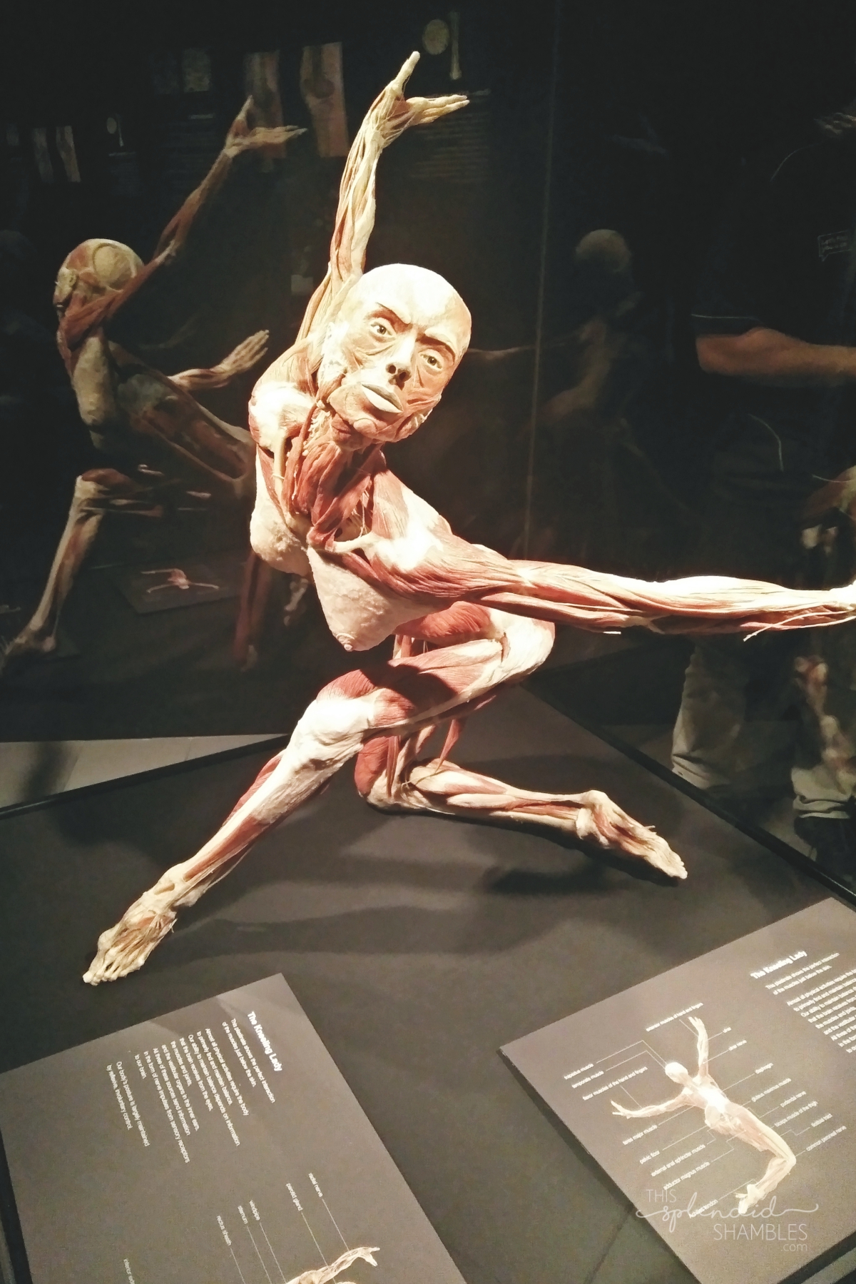 Body Worlds Exhibition VITAL Auckland New Zealand Ballet Dancer