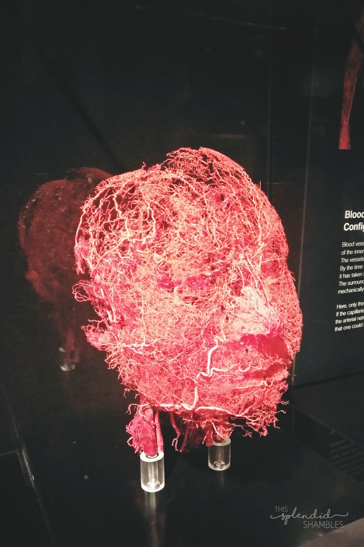 Body Worlds Exhibition VITAL Auckland New Zealand Face Blood Vessels
