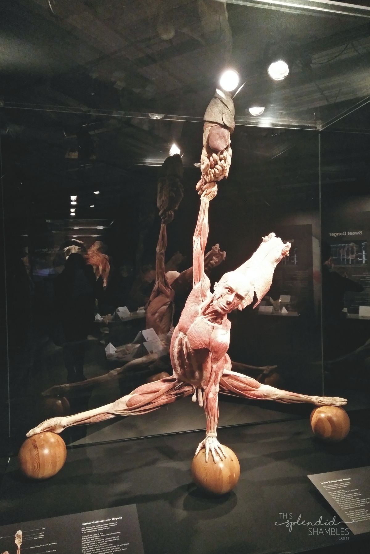 Body Worlds Exhibition VITAL Auckland New Zealand Organ Holding